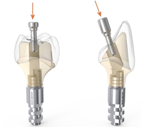 Picture for category Ti-Bases
